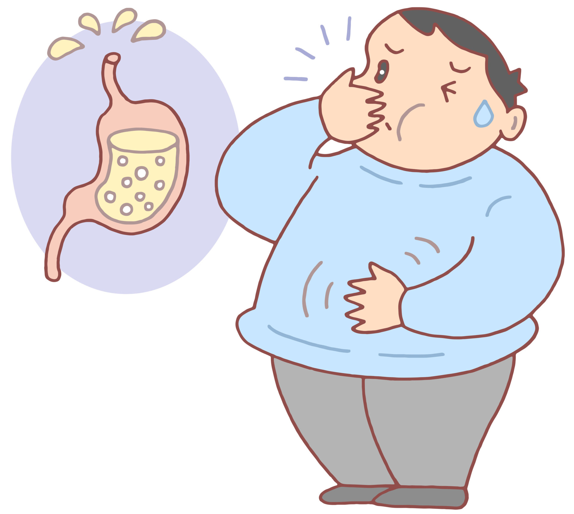【イラスト】逆流性食道炎